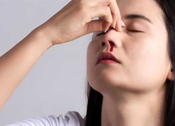 ماذا تفعل لو أصابك نزيف الأنف ؟.. طرق سريعة وعملية لإيقافه في دقائق ماذا تفعل لو أصابك نزيف الأنف ؟.. طرق سريعة وعملية لإيقافه في دقائق