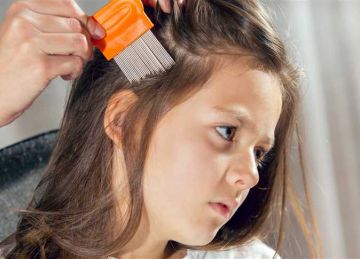  موسم المدارس وقمل الشعر .. كيف تتجنبي العدوى السريعة بين الأطفال؟