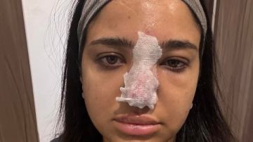 كنت هخسر مناخيري وأتعمى.. القصة الكاملة لأزمة البلوجر كنزي مدبولي كنت هخسر مناخيري وأتعمى.. القصة الكاملة لأزمة البلوجر كنزي مدبولي