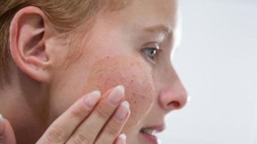 فرط تعرق الوجه.. أسباب وحلول