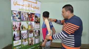 جمعية الأورمان تسلم أجهزة تعويضية وكراسي متحركة للمرضى غير القادرين بقنا