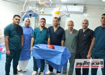 نجاح استئصال ورم ضخم زنة 5 كجم بمستشفى كفر الشيخ العام