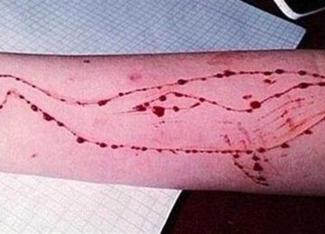 تبدأ باختبارات الطاعة.. أخطر 5 مهام في لعبة الحوت الأزرق 