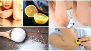 وصفات طبيعية للتخلص من اسمرار الكوعين وإزالة الجلد الميت خلال أسبوعين