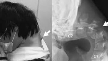 نشرة المرأة والمنوعات أضرار وضع الخيار في لانش بوكس طفلك.. مراهق يصاب بسكتة دماغية بسبب استخدام الهاتف