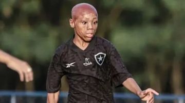 من الحروق إلى حلم الملاعب.. قصة الطفل البرازيلي برناردو لوبيز من الحروق إلى حلم الملاعب.. قصة الطفل البرازيلي برناردو لوبيز