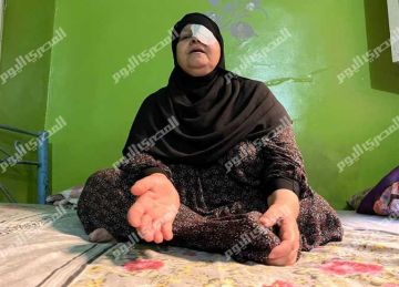  دخلنا لإزالة مياه بيضاء وخرجنا بعين واحدة قصص ضحايا مستشفى الدقي تكشف كواليس الكارثة الصحية