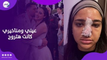 كنت هفقد مناخيري واتعمي.. حقنة فيلر كانت هتضيع كنزي مدبولي