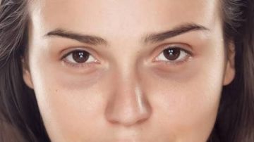 وصفات طبيعية للتخلص من الهالات السوداء تحت العين.. نتائج فعالة بعناصر من مطبخك