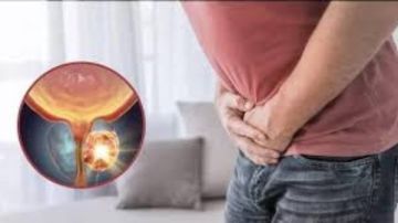 عشبة غير متوقعة تكافح سرطان المبيض والبروستاتا والجلد.. تعرف عليها