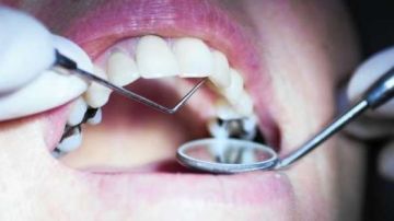 لدينا 3 دفعات مهملة.. المهن الطبية تكشف عن أزمة جديدة لأطباء الأسنان