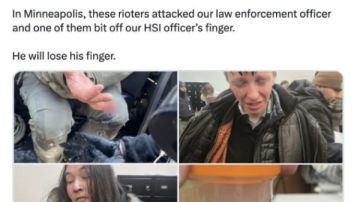 حادثة مروعة في مينيابوليس.. ضابط فيدرالي يفقد طرف إصبعه بسبب عضة أثناء احتجاجات