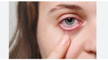 عينك بتحرقك في الشتاء .. كل ما تود معرفته عن جفاف العين