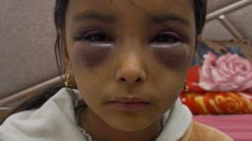 زوجة الأب تعتدي بالضرب المبرح على صغار زوجها.. والأمن يكشف الحقيقة