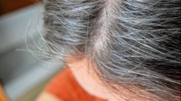 عجزت في عز شبابك .. اعرف أسباب الشيب المبكر