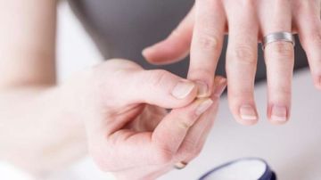 كل ما تريد معرفته عن اصفرار الأظافر .. أسباب وحلول