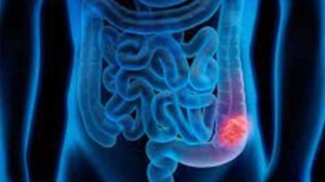 بتترمي في الزبالة .. مادة مهملة تمنع الأمراض الشائعة وتعالج القولون