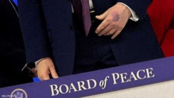 صور جديدة تعيد الجدل حول صحة ترامب بعد ظهور كدمة في يده صور جديدة تعيد الجدل حول صحة ترامب بعد ظهور كدمة في يده