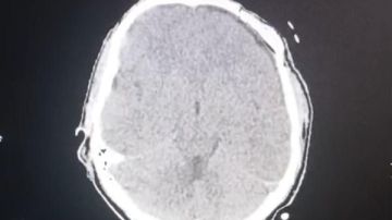 الدقهلية.. إنقاذ حياة شاب من إصابات بالغة في الرأس بمستشفى تمي الأمديد