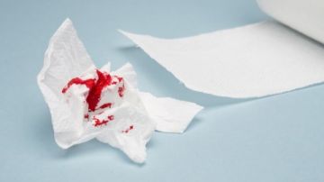 النزيف المهبلي بعد سن اليأس .. ما أسبابه ومتى يكون مقلقا؟