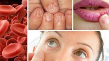 نقص الحديد عند النساء بين ضعف الامتصاص وخطأ العادات اليومية تفاصيل نقص الحديد عند النساء بين ضعف الامتصاص وخطأ العادات اليومية تفاصيل