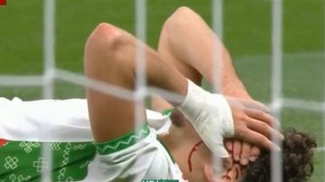 إصابة خطيرة للعيناوي لاعب المغرب أمام السنغال في نهائي أمم إفريقيا إصابة خطيرة للعيناوي لاعب المغرب أمام السنغال في نهائي أمم إفريقيا