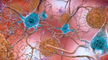 تحذير .. أعراض كوفيد طويل الأمد تزيد خطر الإصابة بـ الزهايمر