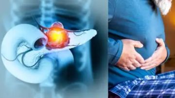 إنجاز طبي.. باحثون يطورون علاجا يقضي على سرطان البنكرياس المميت إنجاز طبي.. باحثون يطورون علاجا يقضي على سرطان البنكرياس المميت