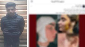 واقعة مأساوية.. شاب يشوه وجه فتاة بـ49 غرزة في العجوزة