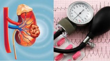 تحذير عاجل ارتفاع ضغط الدم يصيبك بمرض مميت