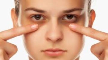 لماذا تظهر الهالات فجأة حتى مع النوم الكافي؟