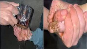  تصل إلى الوفاة ..تحذير طبي من خطورة تريند كوباية الشاي 