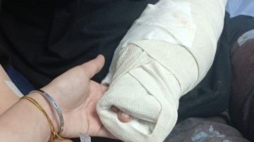 مكنة الجبنة قطعت أيدها طالبة جامعية تستغيث من سوبر ماركت شهير .. القصة الكاملة