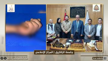 نجاح جراحة زراعة يد مبتورة بمستشفيات جامعة الزقازيق نجاح جراحة زراعة يد مبتورة بمستشفيات جامعة الزقازيق