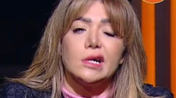 بعد إصابة لقاء سويدان.. أعراض وأسباب العصب السابع