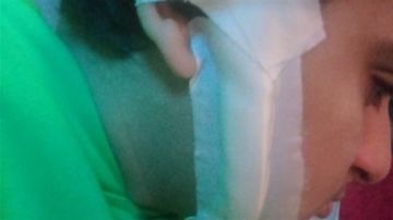 تسبب له بعاهة مستديمة.. والدة طالب البحيرة بعد إصابته بـ50 غرزة في الوجه على يد زميله: عايزة حق ابني