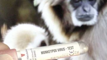 الكاميرون ترفع مستوى التأهب الصحي بسبب تفشي جدري القرود الكاميرون ترفع مستوى التأهب الصحي بسبب تفشي جدري القرود