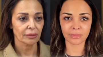 حاسة إني لسة صغيرة.. داليا البحيري تتصدر التريند بعد عملية تجميل شاهد