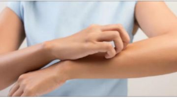 خلي بالك.. الحكة المستمرة تنذر بالإصابة بـ 3 أمراض مميتة