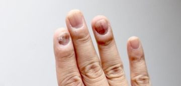 علامات على أظافرك تحذر من مشاكل صحية لا تعرفينها
