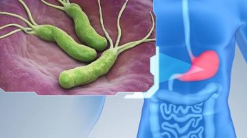 الكركم والثوم الأبرز.. 7 مكونات للتخلص من جرثومة المعدة طبيعيا الكركم والثوم الأبرز.. 7 مكونات للتخلص من جرثومة المعدة طبيعيا