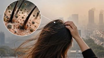 مفاجأة صادمة... هل يمكن لتلوث الهواء أن يسبب تساقط الشعر ؟ مفاجأة صادمة... هل يمكن لتلوث الهواء أن يسبب تساقط الشعر ؟