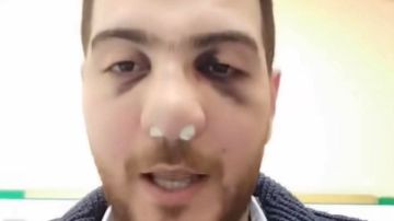 إخلاء سبيل الطبيب المعتدى عليه بمستشفى الباجور بكفالة 10 الاف جنيه