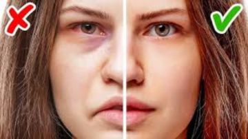 لا تتجاهل هذا العرض في وجهك.. قد لا يكون تعبا