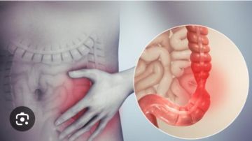 معلومات لا تعرفها عن التهاب الأمعاء .. أكثر من مجرد مشاكل هضمية 