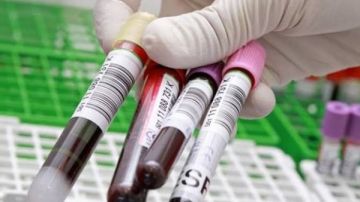 كيفية قراءة صورة الدم الكاملة.. مشاكل صحية قد تكشها