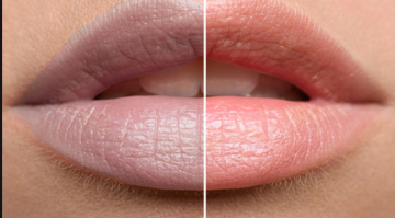 بمكون واحد.. وصفتين لعلاج إسمرار الشفاة