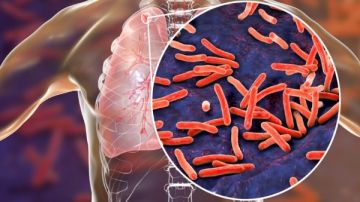 أعراض الالتهاب الرئوي .. وهذه مؤشرات الخطر