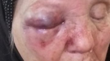 الابن العاق.. ضرب أمه للحصول على أموال لشراء مخدرات بالغربية والأمن يطارده الابن العاق.. ضرب أمه للحصول على أموال لشراء مخدرات بالغربية والأمن يطارده