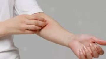 ياسر حلمي: الجلد أكبر أعضاء الجسم.. درع مناعي يصنع فيتامين د ويقاوم العدوى ياسر حلمي: الجلد أكبر أعضاء الجسم.. درع مناعي يصنع فيتامين د ويقاوم العدوى